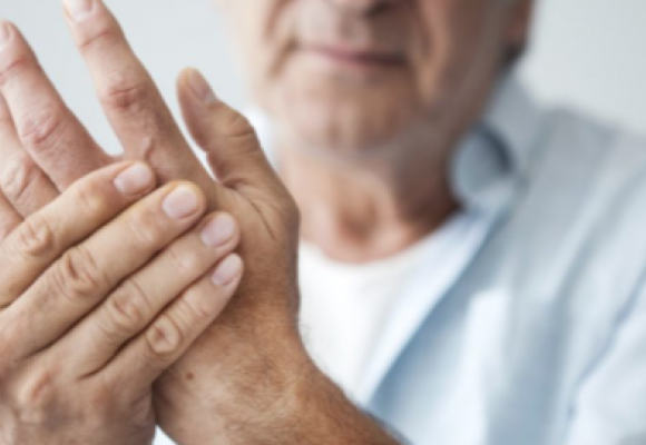 dealing with arthritis pain